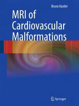 MRI of Cardiovascular Malformations