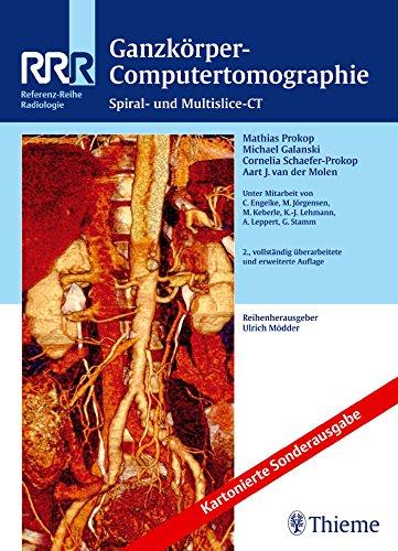 Ganzkörper-Computertomographie: Spiral- und Multislice-CT (Reihe, REF.-R. RADIOLOGIE)