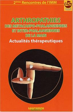 Arthropathies des métacarpo-phalangiennes et inter-phalangiennes de la main : actualités thérapeutiques