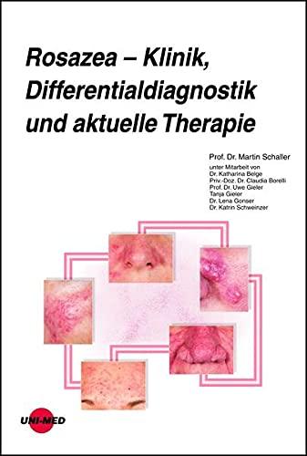 Rosazea – Klinik, Differentialdiagnostik und aktuelle Therapie (UNI-MED Science)