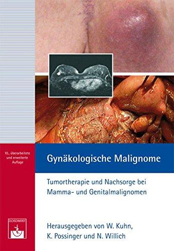 Gynäkologische Malignome: Tumortherapie und Nachsorge bei Mamma- und Genitalmalignomen