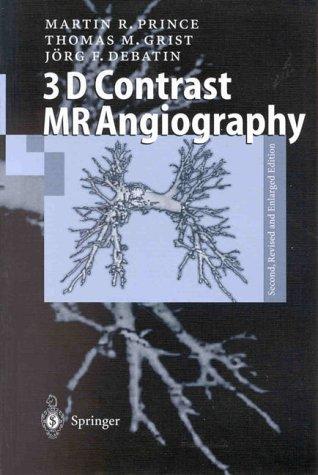 3D Contrast MR Angiography