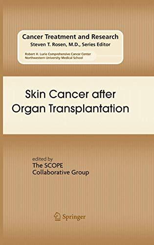 Skin Cancer after Organ Transplantation (Cancer Treatment and Research, 146, Band 146)