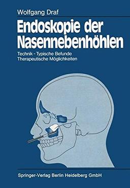 Endoskopie der Nasennebenhöhlen: Technik · Typische Befunde, Therapeutische Möglichkeiten