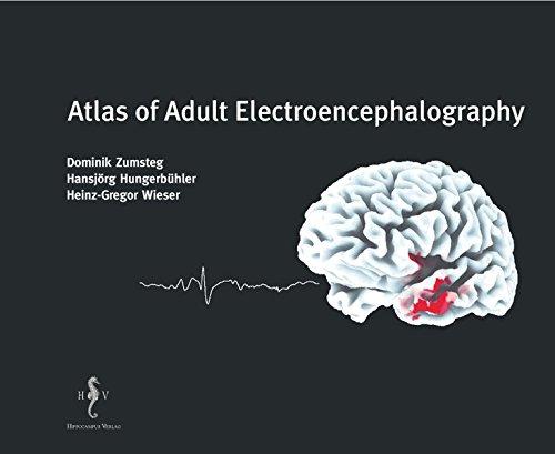 Atlas of Adult Electroencephalography