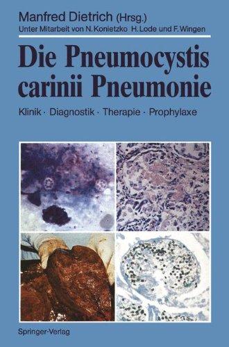 Die Pneumocystis carinii Pneumonie: Klinik · Diagnostik · Therapie · Prophylaxe