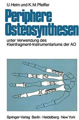 Periphere Osteosynthesen: Unter Verwendung des Kleinfragment-Instrumentariums der AO