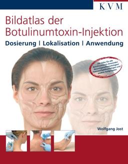 Bildatlas der Botulinumtoxin-Injektion. Dosierung - Lokalisation - Anwendung