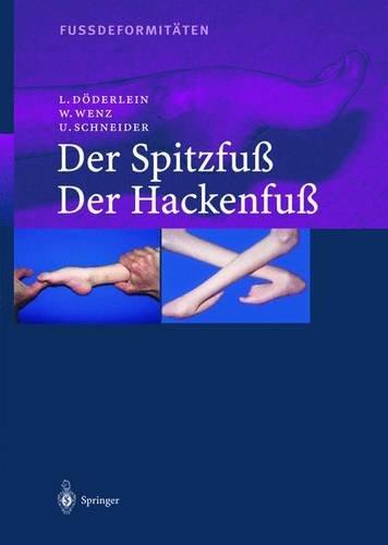 Fussdeformitäten: Der Spitzfuß / Der Hackenfuß