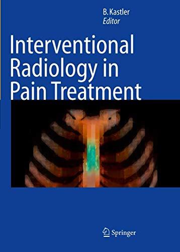 Interventional Radiology in Pain Treatment