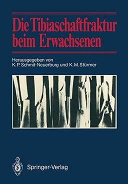 Die Tibiaschaftfraktur beim Erwachsenen: Symposium anläßlich des 10jährigen Bestehens der Abteilung für Unfallchirurgie am Klinikum Essen, 1./2. Februar 1985 in Essen