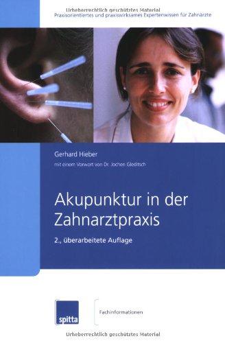 Akupunktur in der Zahnarztpraxis