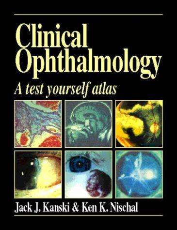 Clinical Opthalmology: A Test Yourself Atlas