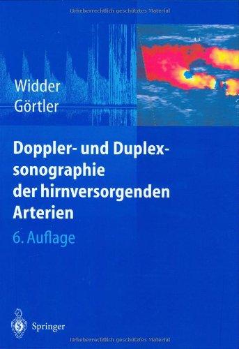 Doppler- und Duplexsonographie der hirnversorgenden Arterien