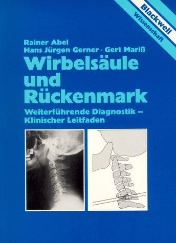 Wirbelsäule und Rückenmark. Weiterführende Diagnostik - Klinischer Leitfaden