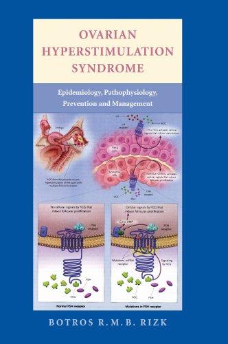 Ovarian Hyperstimulation Syndrome: Epidemiology, Pathophysiology, Prevention and Management