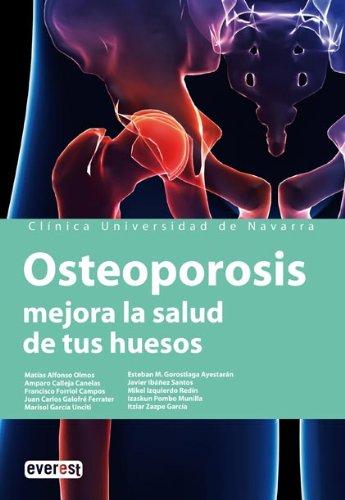 Osteoporosis, mejora la salud de tus huesos: Consigue más calidad de vida conociéndola y tratándola a tiempo. (Manuales de la Clínica Universitaria de Navarra)