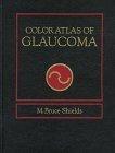 Color Atlas of Glaucoma