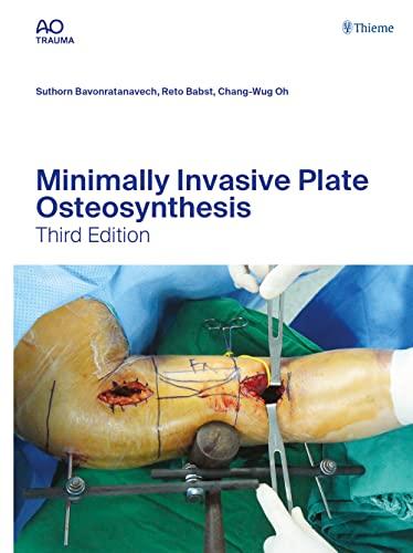 Minimally Invasive Plate Osteosynthesis