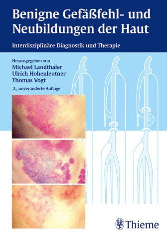 Benigne Gefäßfehl- und Neubildungen der Haut. Interdisziplinäre Diagnostik und Therapie