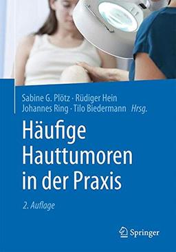 Häufige Hauttumoren in der Praxis