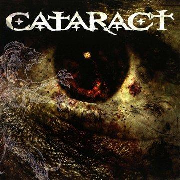 Cataract