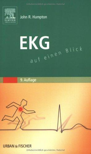 EKG: auf einen Blick