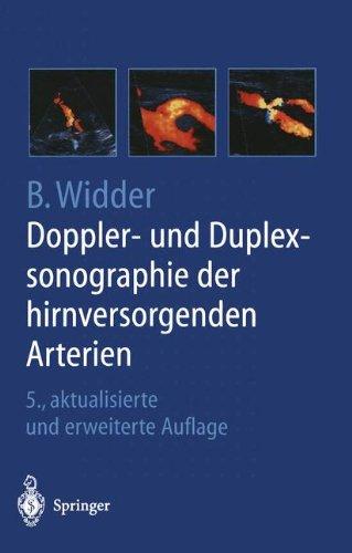 Doppler- und Duplexsonographie der hirnversorgenden Arterien