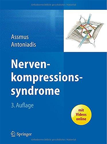 Nervenkompressionssyndrome