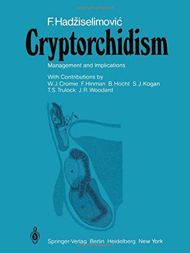 Cryptorchidism: Management and Implications