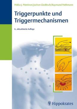 Triggerpunkte und Triggermechanismen