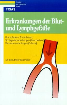 Erkrankungen der Blut- und Lymphgefäße