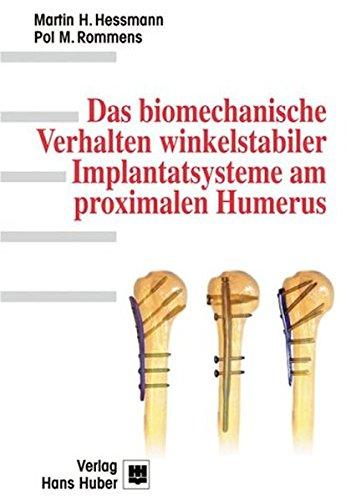 Das biomechanische Verhalten winkelstabiler Implantatsysteme am proximalen Humerus