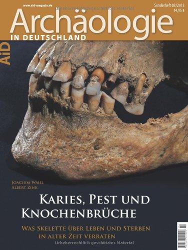 Karies, Pest und Knochenbrüche