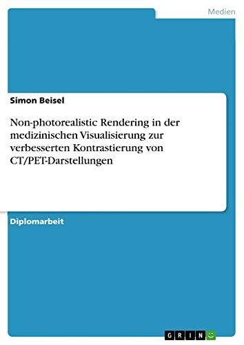 Non-photorealistic Rendering in der medizinischen Visualisierung zur verbesserten Kontrastierung von CT/PET-Darstellungen: Diplomarbeit