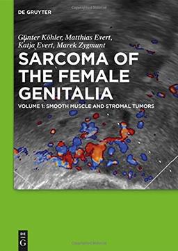 Sarcoma of the Female Genitalia: Smooth muscle and stromal tumors and prevention of inadequate surgery: Volume 1: smooth muscle and stromal tumors