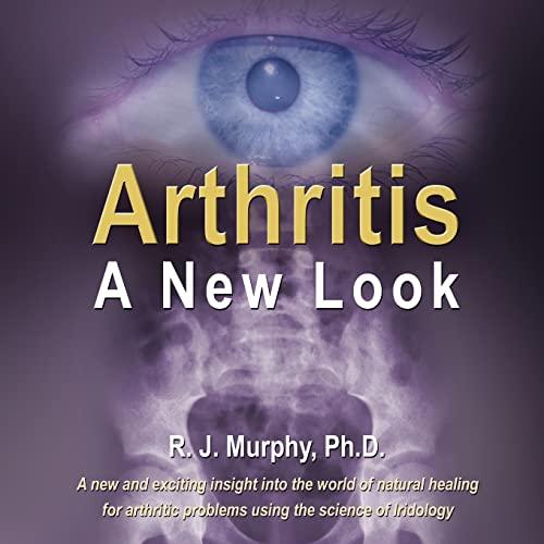 Arthritis-A New Look: Arthritic Indicators As Seen In The Eyes