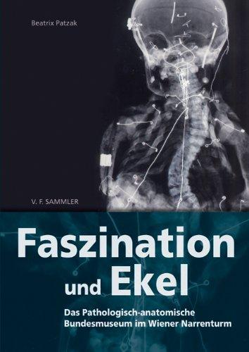 Faszination und Ekel: Das Pathologisch-anatomische Bundesmuseum im Wiener Narrenturm