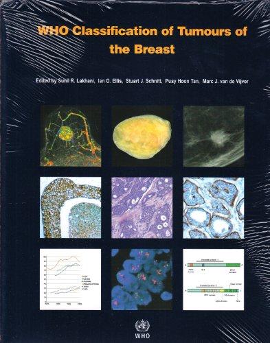 IARC WHO Classification of Tumours, Band 4: WHO Classification of Tumours of the Breast