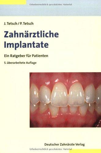 Zahnärztliche Implantate: Ein Ratgeber für Patienten