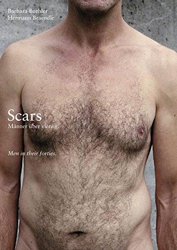 Scars - Männer über vierzig/men in their Forties