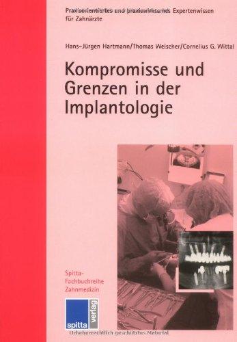 Kompromisse und Grenzen in der Implantologie