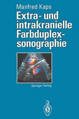 Extra - Und Intrakranielle Farbduplexsonographie