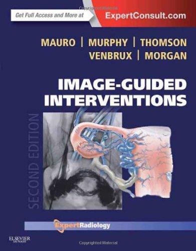 Image-Guided Interventions: Expert Radiology Series. Expert Consult - Online and Print