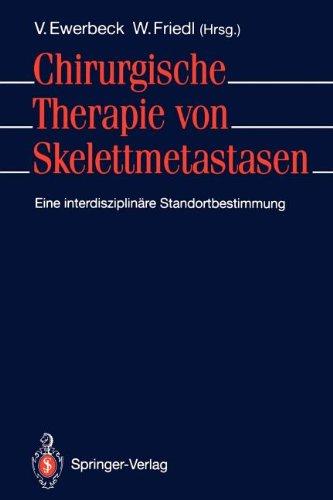 Chirurgische Therapie von Skelettmetastasen: Eine interdisziplinäre Standortbestimmung