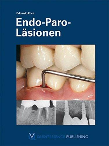 Endo-Paro-Läsionen