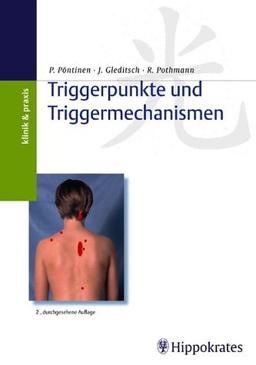 Triggerpunkte und Triggermechanismen