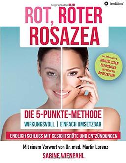 ROT RÖTER ROSAZEA: Die "5-Punkte-Methode" – Endlich Schluss mit Gesichtsröte und Entzündungen