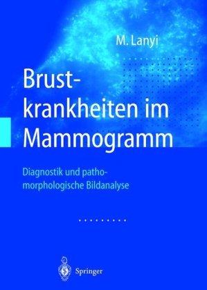 Brustkrankheiten im Mammogramm: Diagnostik und pathomorphologische Bildanalyse