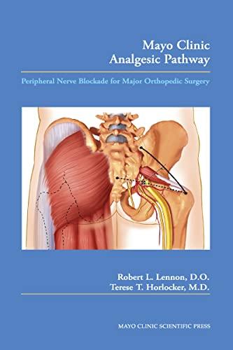 Lennon, R: Mayo Clinic Analgesic Pathway: Peripheral Nerve Blockade for Major Orthopedic Surgery